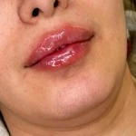 نمونه کار کلینیک زیبایی و لیزر نگین شرق