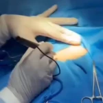 مطب پوست و زیبایی