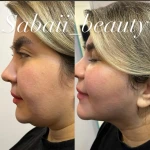 مرکز پوست مو و زیبایی صبا