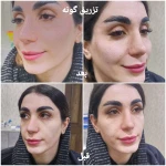 کلینیک زیبایی و لیزر مو گندم