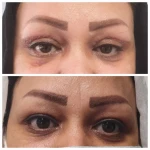 نمونه کار متخصص پوست مو زیبایی لیزر دکتر فرزانه علمشاهی