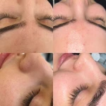 خدمات تخصصی پاکسازی پوست ساجده عنایتی