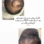 تصویر کلینیک پوست و مو و لیزر و زیبایی دنیز