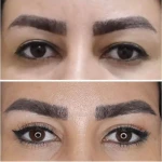 تصویر جراحی  زیبایی بینی  و صورت نئوفیس