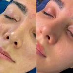 مرکزتخصصی کراتین تهرانپارس