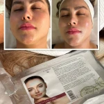 فشیال و پاکسازی پوست اوپال