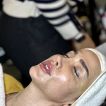 کلینیک پاکسازی پوست و لیزرکندلا رها