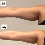 تصویر کلینیک تخصصی لاغری موضعی ولافیت