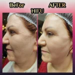 کلینیک زیبایی و لاغری یسنا