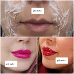 نمونه کار لیزر و خدمات زیبایی گیتی مهر
