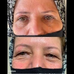 دکتر محمد امید بهترین دکتر زیبایی کانتور