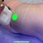 کلینیک زیبایی و لیزر نور