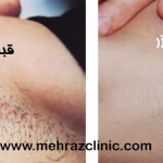 کلینیک زیبایی مهراز