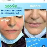 کلینیک پوست مو زیبایی و لیزر آدونیس