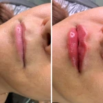 کلینیک زیبایی دکتر فاطمه کوچالی