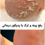 پدیکور و پودولوژیSD