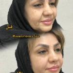 کلینیک لیزر و زیبایی مهرُنا