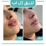 کلینیک لیزر و زیبایی لیلیا