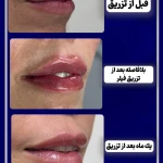 نمونه کار کلینیک زیبایی دکتر زهره صادقی