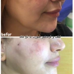 مرکز پوست و زیبایی دکتر شهلا وزیری نسب