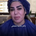 تصویر مرکز کاشت مو،فیلربادی و لیفت صورت النا
