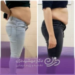 کلینیک تغذیه  رژیم درمانی دکتر مهشید دژن