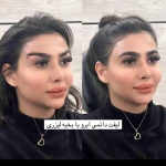 نمونه کار کلینیک زیبایی بلا