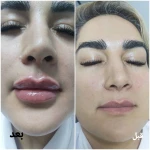کلینیک زیبایی و لیزر مو گندم