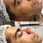 فیشال تخصصی  سعیده صدیقی