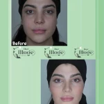 کلینیک زیبایی درموگه