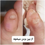 تصویر پدیکور و پودولوژیSD