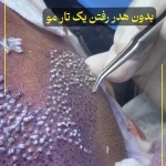 تصویر کلینیک تخصصی کاشت مو و ابرو رویش سبز