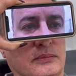 کلینیک زیبایی ژاله