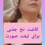 مرکز لیفت پوست و درمان ریزش مو مرجان