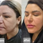 تصویر مرکز زیبایی و لیزر دکتر مریم نوکنده