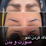 کلینیک پوست ،زیبایی و لیزر دکتر زمانی