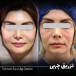 کلینیک زیبایی تهران بیوتی سنتر