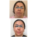 مطب زیبایی دکتر بهمنی