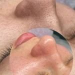 کلینیک زیبایی و پاکسازی پوست پاریزبیوتی