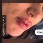مرکز سولاریوم بانوان و زیبایی رها بیوتی