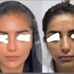 تصویر کلینیک زیبایی و مرکز لیزر موی زائد آریسا