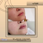 کلینیک زیبایی و لیزر لیزا