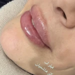کلینیک تخصصی پوست و زیبایی بهشاد