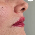 تصویر مرکز لیزر و فیلر وجوانسازی وزیبایی شاینا