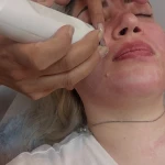 مطب پوست ،مو زیبایی دکتر فاطمه قره داغی