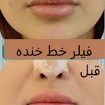 کلینیک پوست مو لیزر لاغری زیباریس