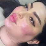 تصویر کلینیک زیبایی بلا