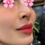  کلینیک زیبایی و لیزر لوسیفر