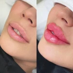 کلینیک زیبایی و مرکز لیزر و هایفو مرکز دلورا