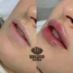 کلینیک زیبایی بلژو